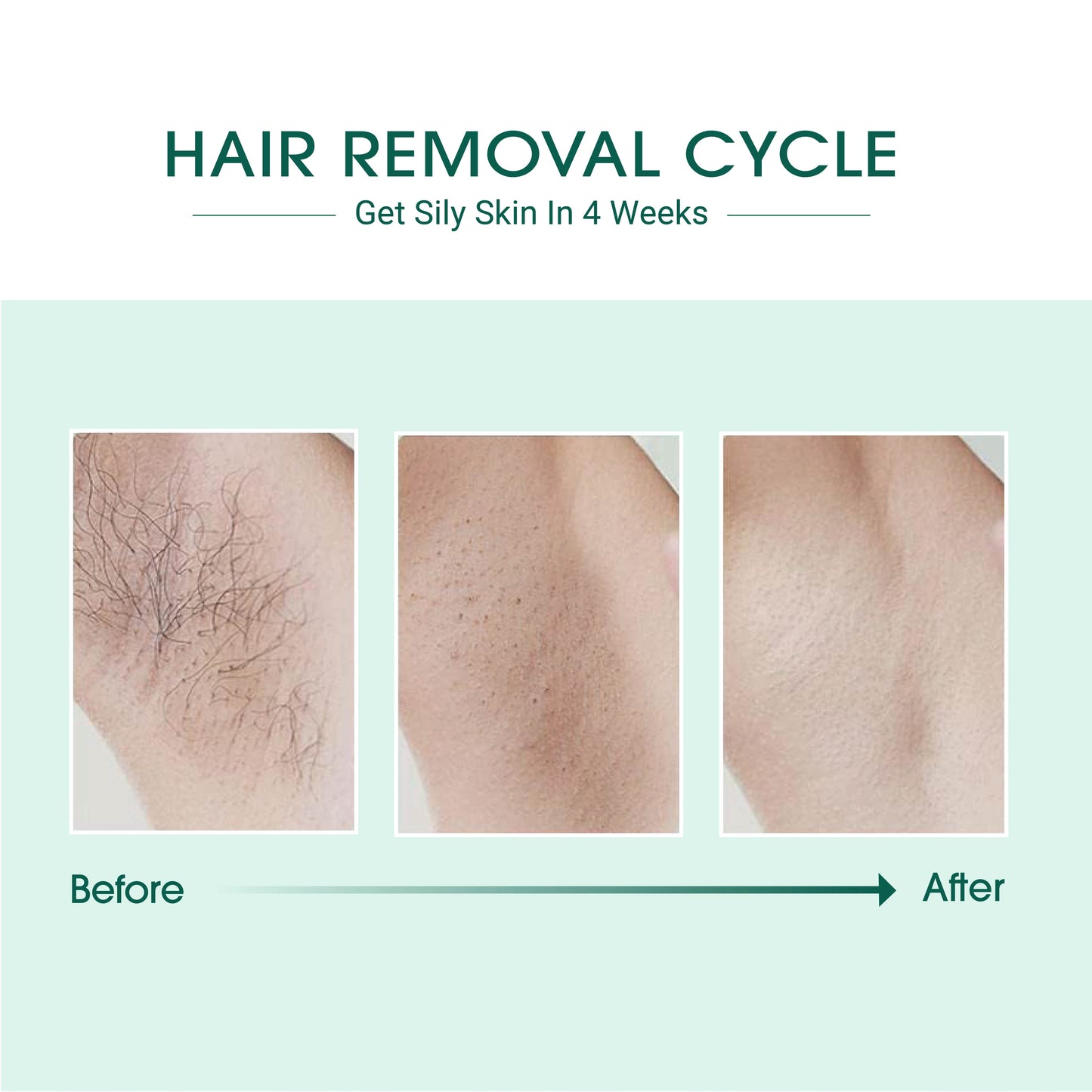 VYRK THE VYRK RAY — IPL Laser Hair Removal Device
