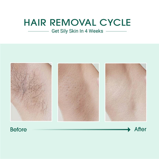 VYRK THE VYRK RAY — IPL Laser Hair Removal Device